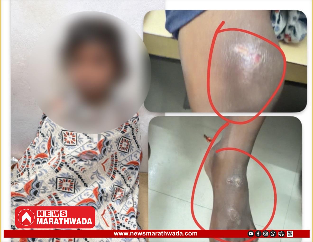 सख्या आईच्या मदतीने सावत्र वडिलाचा अत्याचार; ७ वर्षीय मुलीचे धैर्य, शेजाऱ्यांनी वाचवले जीव